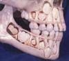 Kid's skull before protrusion of their baby teeth