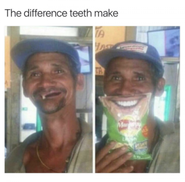 The difference teeth make 